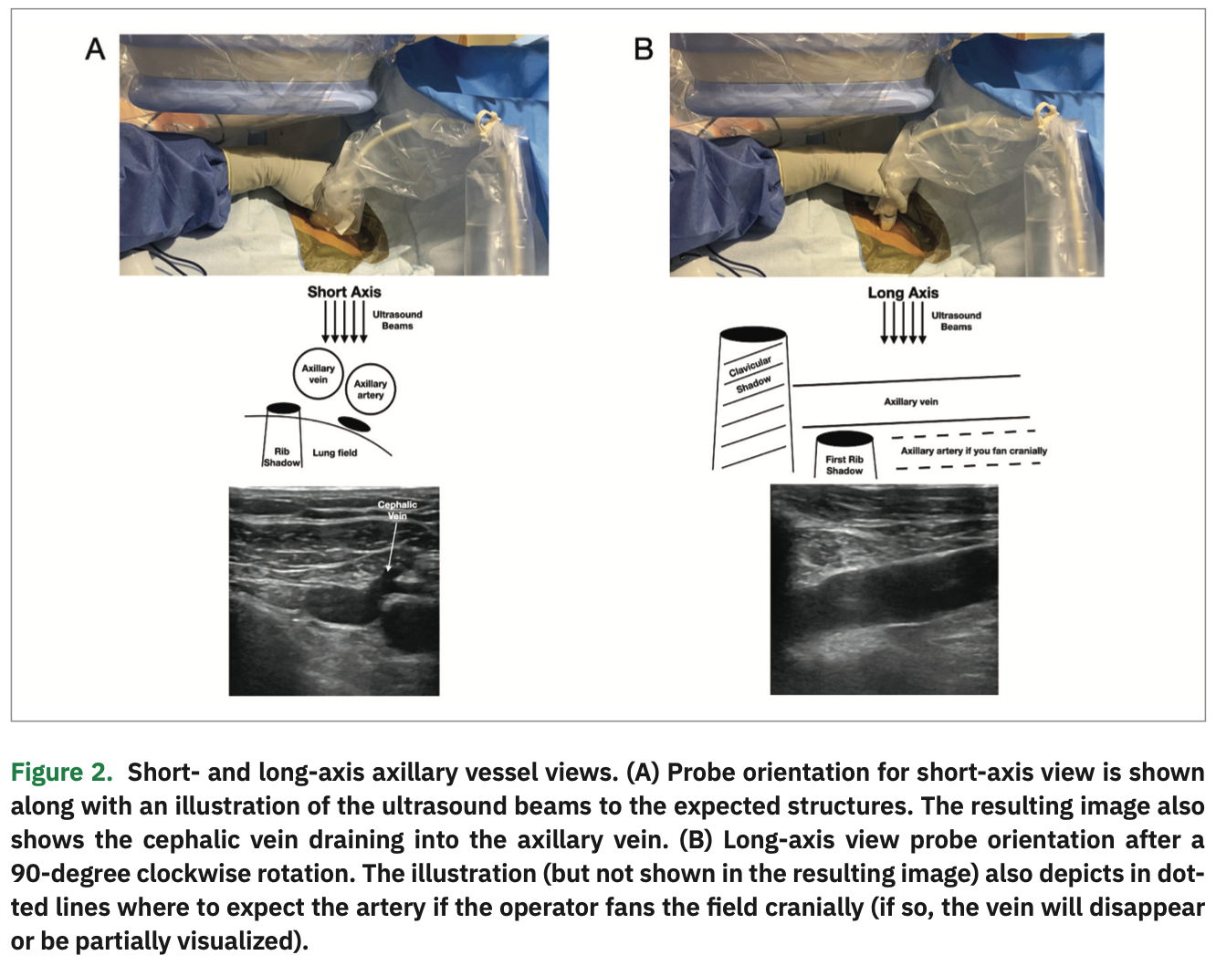 Integrating LongAxis and ShortAxis Views With a Twist for Ultrasound